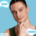 Tereson 2x Antitranspirant Gel 50 ml, Starkes Schwitzen,Bei Schwitzen im Gesicht